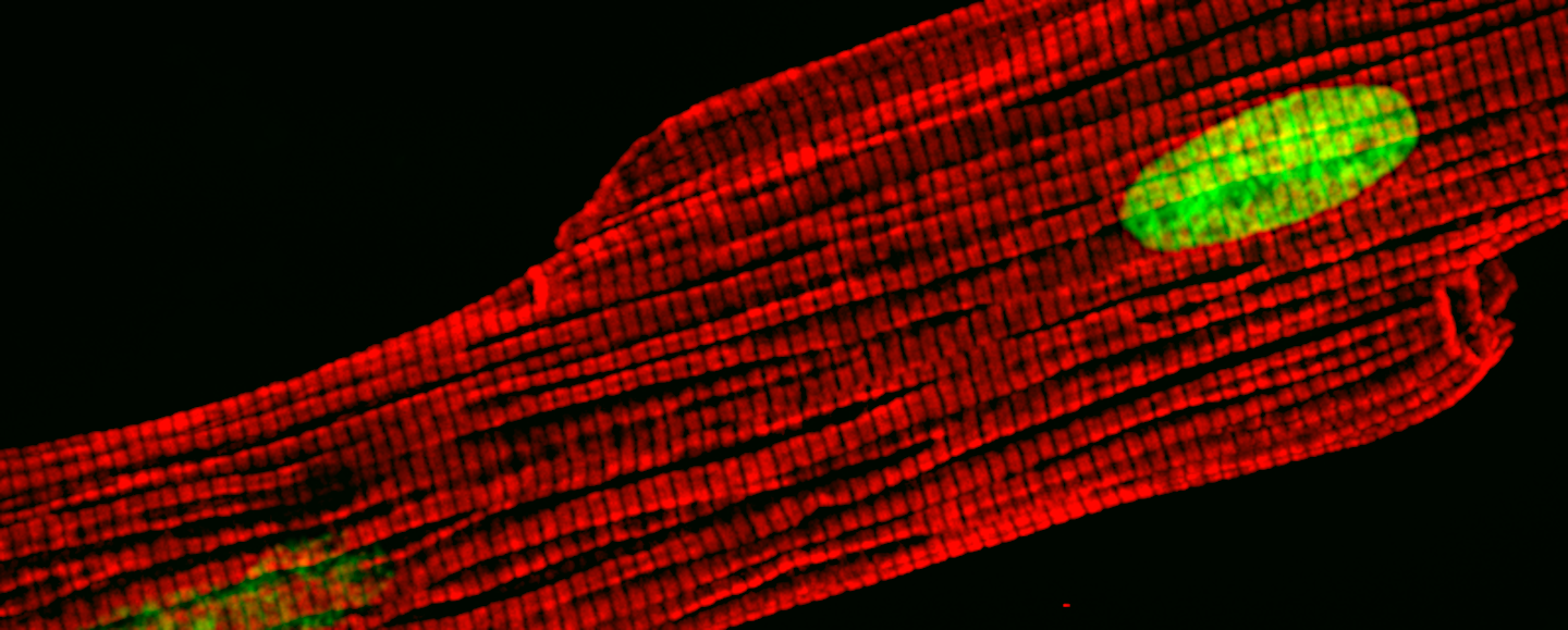 Laser scanning confocal microscope image of a cardiomyocyte showing sarcomere bundles